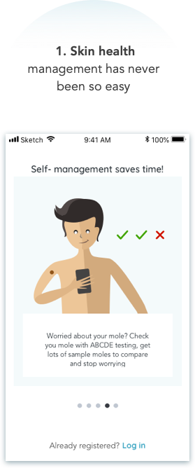MoleCare - Track your moles