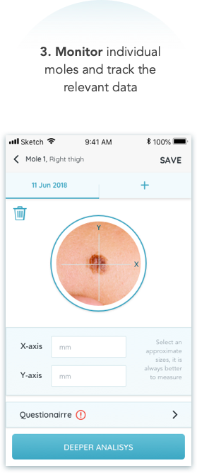 MoleCare - Body Map